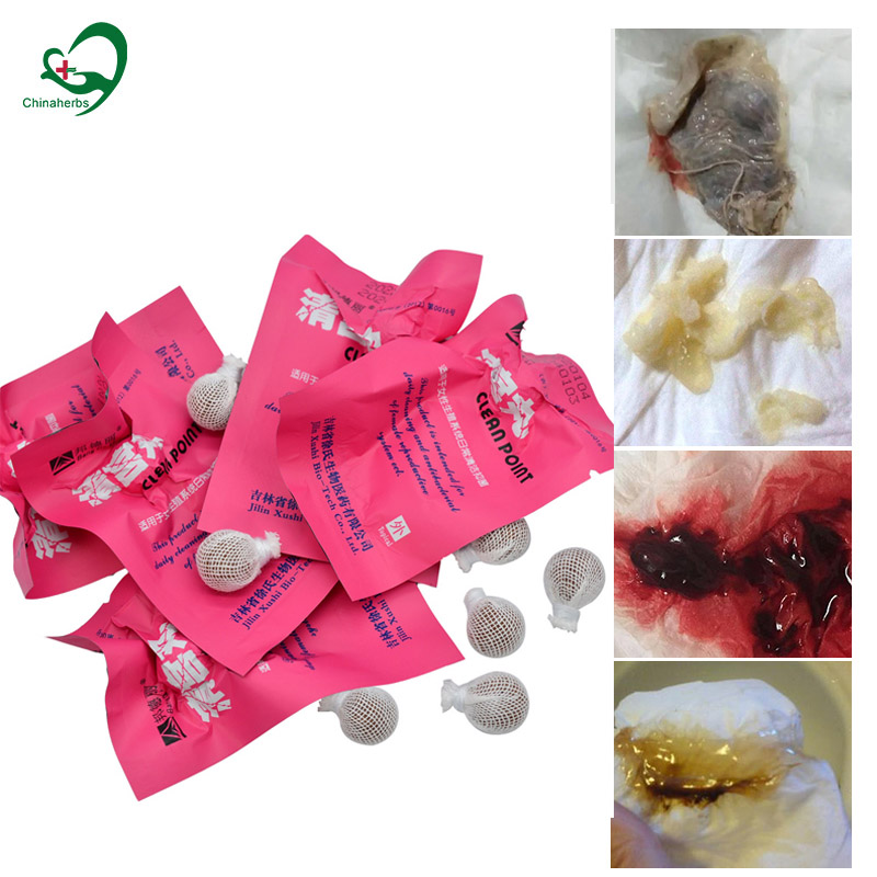 Medical Wellness & Spa Werona - 20 Chiếc Yoni Ngọc Trai Sạch